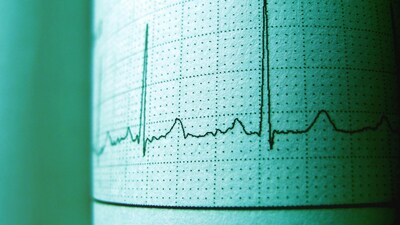 Symptoms of Prinzmetal’s Angina: Also called cold-induced coronary spasm, it is a rare heart condition in which the coronary arteries suddenly clamp down, reducing blood flow to the heart. (Image: Pexels)