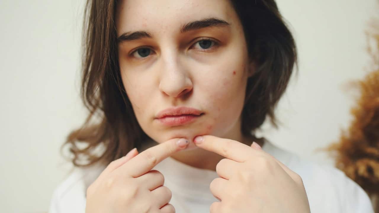 Acne, pigmentation and sunscreen: How India’s skincare habits are growing up fast