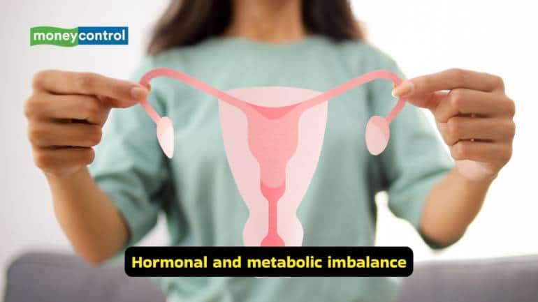 Understanding Polycystic Ovarian Syndrome (Images: Canva) Understanding Polycystic Ovarian Syndrome (Images: Canva)