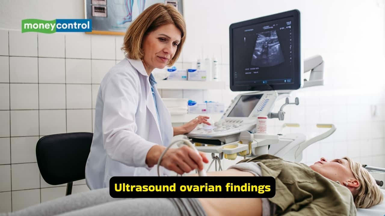 Understanding Polycystic Ovarian Syndrome (Images: Canva) Understanding Polycystic Ovarian Syndrome (Images: Canva)