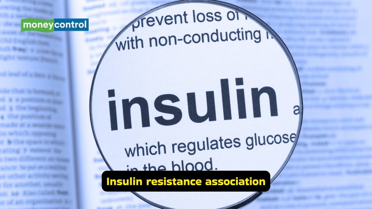 Insulin resistance association PCOS is strongly associated with insulin resistance, affecting both obese and lean women. Elevated insulin levels exacerbate androgen excess and ovulatory dysfunction, increasing the risk of developing type 2 diabetes mellitus over time. Insulin resistance association PCOS is strongly associated with insulin resistance, affecting both obese and lean women. Elevated insulin levels exacerbate androgen excess and ovulatory dysfunction, increasing the risk of developing type 2 diabetes mellitus over time.