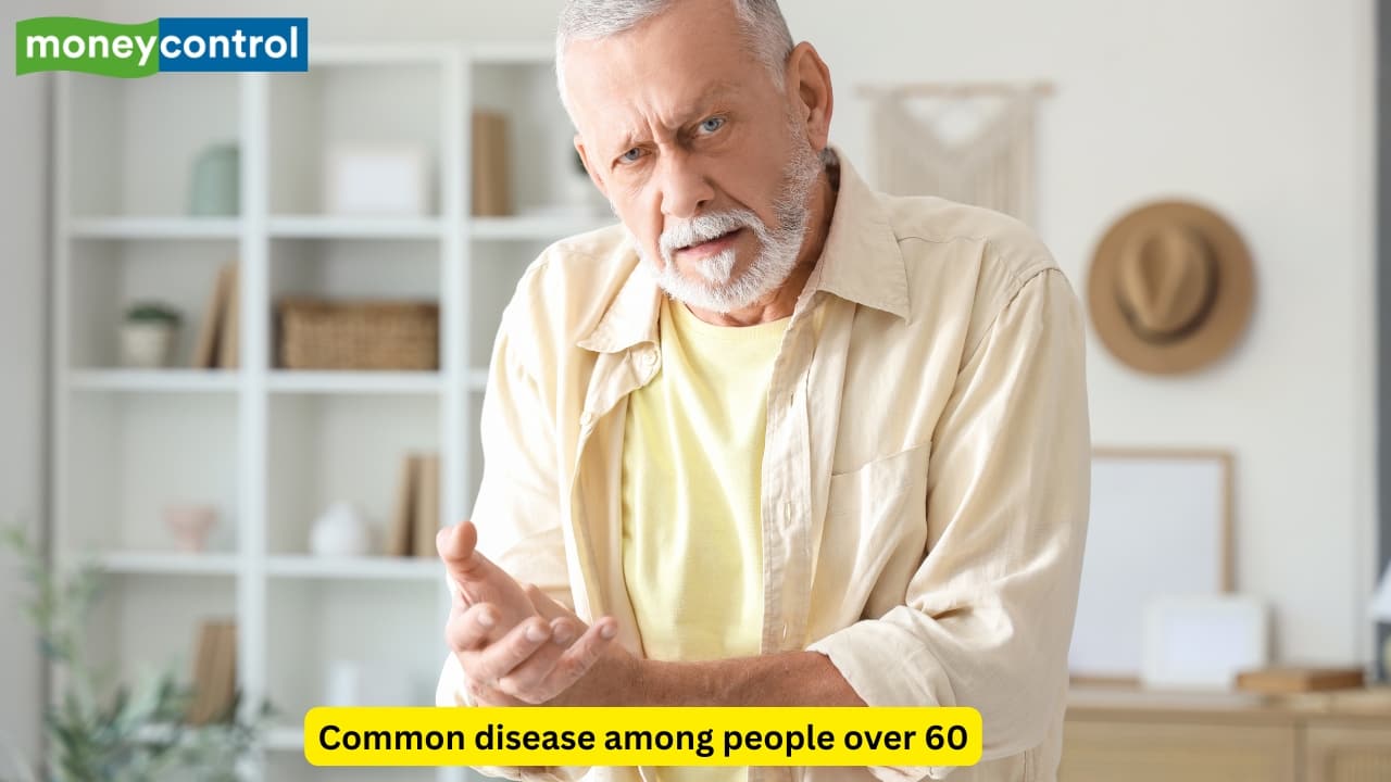 Epidemiology and age group This disease is commonly seen in individuals who are above the age of sixty, and is found more in men as compared to women. However, it may also be seen in younger populations if they are genetically predisposed. 