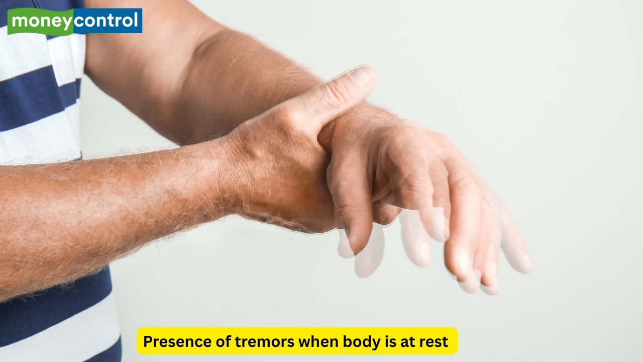 Cardinal motor manifestations One of the cardinal symptoms of this disease is the presence of tremors. Other symptoms like postural instability may also be observed. A “pill-rolling” type of tremor occurs at rest, and reduces when the affected individual performs any voluntary movement. 