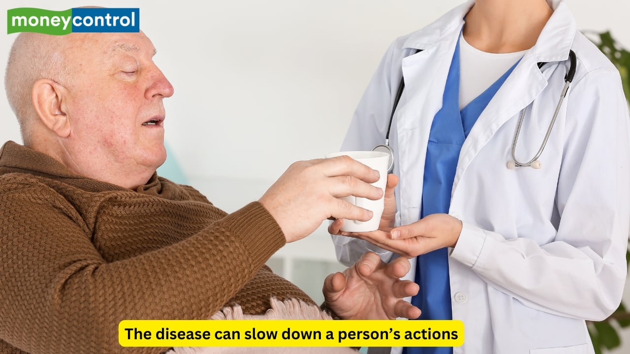 Bradykinesia and slowness A slowness in the actions performed is known as bradykinesia, and is one of the hallmark symptoms of Parkinson’s disease. The person has a difficulty in initiating a movement, and can be one of the most disabling symptoms. 