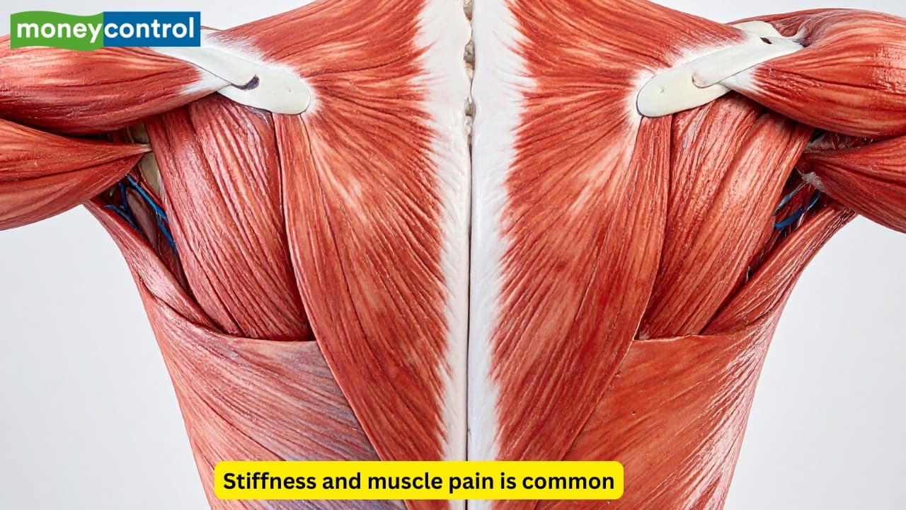 Muscle rigidity patterns As the muscles become rigid, the resistance to passive movements increases. This type of rigidity is known as “lead-pipe” or “cogwheel” rigidity. It may contribute to stiffness and muscle pain, along with a restricted range of motion. 