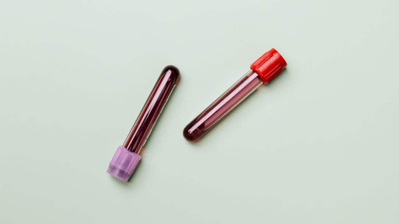 Madhya Pradesh: 5 thalassaemia children contract HIV after blood transfusions