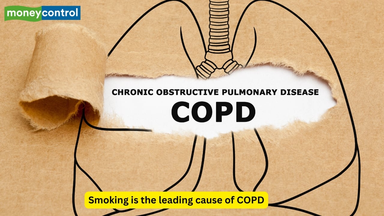 Smoking and COPD Smoking is the predominant cause of chronic obstructive pulmonary disease (COPD), which includes chronic bronchitis and emphysema. COPD leads to irreversible airway obstruction, resulting in chronic cough and progressive breathlessness, significantly affecting quality of life. 