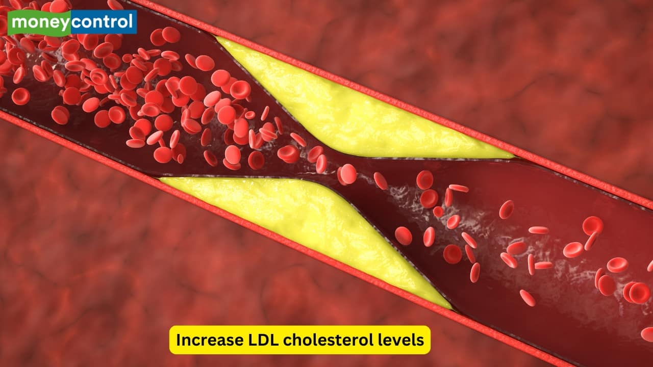 Cardiovascular Complications Long-term smoking accelerates atherosclerosis by damaging blood vessels and increasing LDL cholesterol levels. This predisposes smokers to coronary artery disease, angina, and myocardial infarction, often occurring at a younger age compared to non-smokers. 