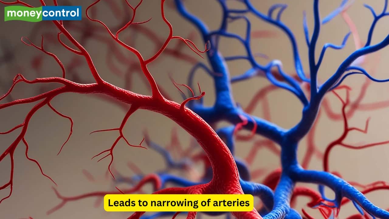 Peripheral Arterial Disease Smoking causes narrowing and blockage of arteries in the lower limbs. Affected individuals experience claudication and rest pain. In advanced stages, non-healing ulcers may develop, increasing the risk of gangrene and limb amputation. 