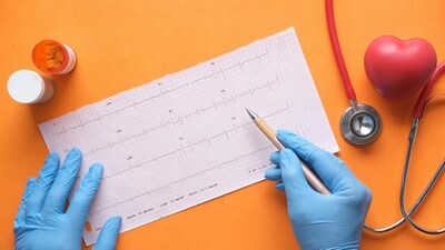 Doctors say advanced lipid tests like Apo B and Lp(a) can identify heart disease risk earlier than standard cholesterol checks. (Image: Pexels)