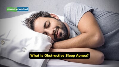 Symptoms and causes of Obstructive Sleep Apnea  (Image: Canva)