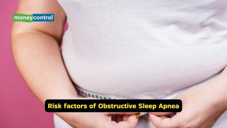 Risk factors of Obstructive Sleep Apnea Craniofacial abnormalities and obesity significantly increase the risk of developing obstructive sleep apnea. The condition is more commonly seen in middle-aged and elderly individuals, with a higher incidence in males. A large neck circumference is also strongly associated with increased airway collapsibility. 