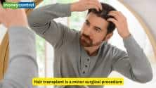 Leading dermatologist busts 5 myths around hair transplant
