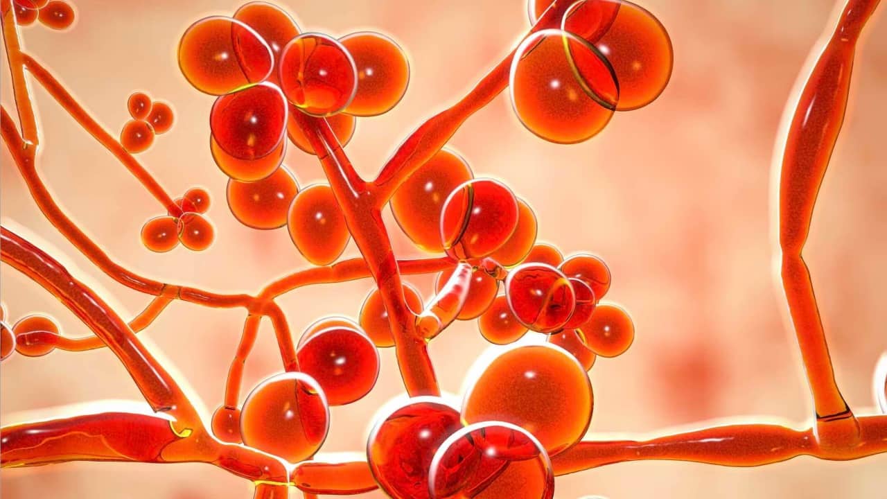 Drug-resistant 'Candida Auris' spreads across 27 US states: Symptoms, risks and why it’s dangerous