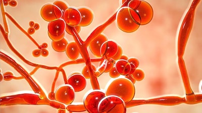 Drug-Resistant 'Candida Auris' Spreads Across 27 US States, Posing Deadly Threat