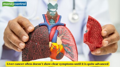 Liver cancer is one of the leading causes of cancer deaths worldwide. (Picture Credit: Canva)