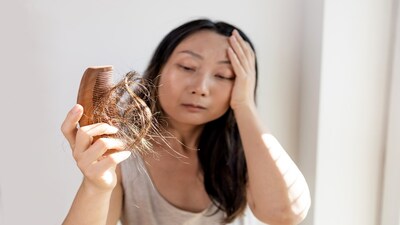Unlock Stronger Hair: Your Diet is the Key to Preventing Hair Fall