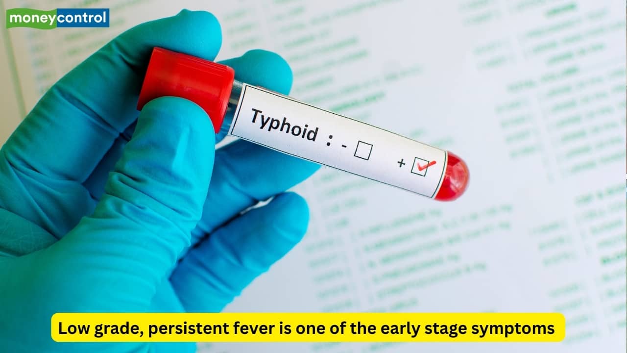 Typhoid cases rise in Gandhinagar, expert shares early symptoms and recovery tips