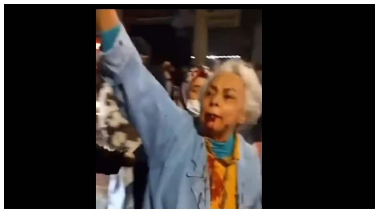 Elderly woman's 'bloody' protest in Iran goes viral: 'Not afraid, been dead for 47 years'