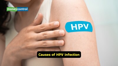 Symptoms of HPV infection: Most young women remain unaware of their HPV infection since the virus, in the initial stages, generally does not cause any pain or abnormal discharge, or discomfort (Image: Canva)