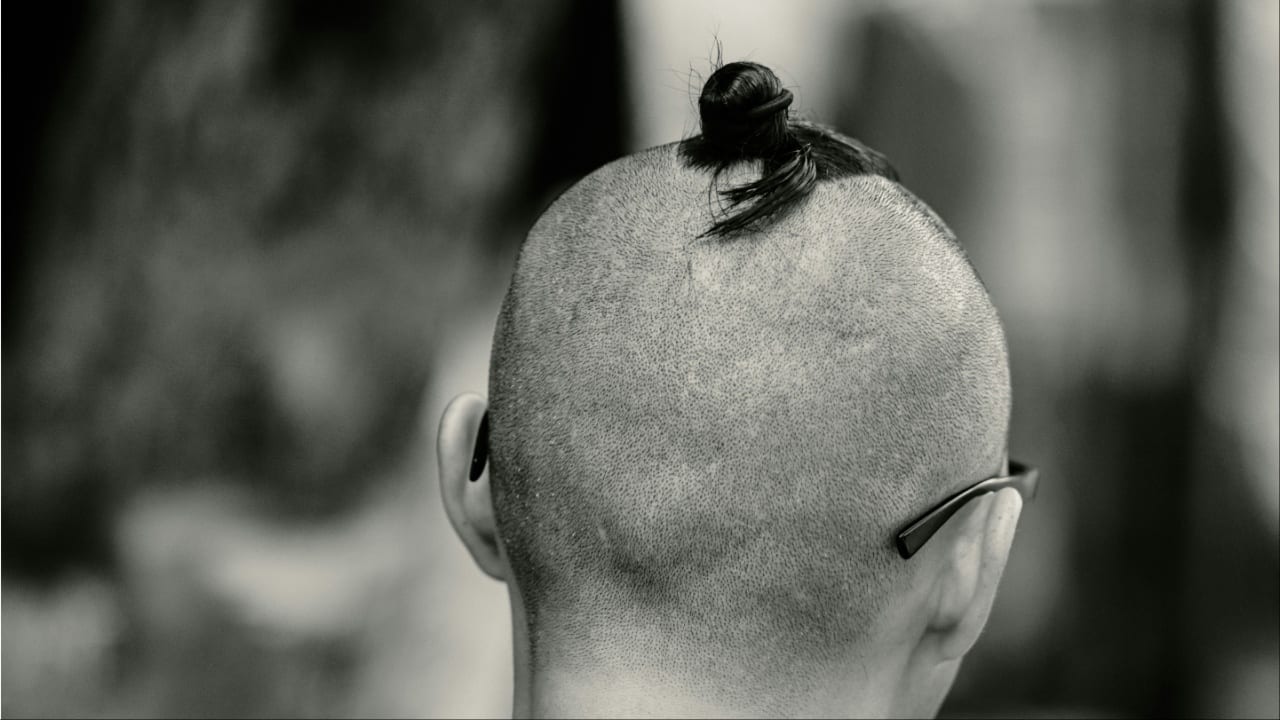 Man divorces ill wife for losing hair, refuses to pay for treatment: 'Never seen such a ruthless man'