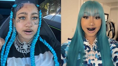 North West black teeth