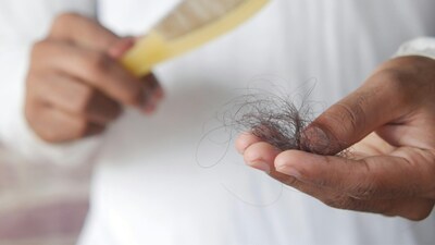 Causes of hair fall: Many hair problems, especially dandruff and premature greying, are because of excess pitta. Methi has a naturally cooling post digestive effect (Image: Pexels)