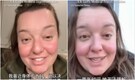 UK patient flies to China, gets Rs 6 lakh procedure done for Rs 36,000, others follow: 'So efficient'