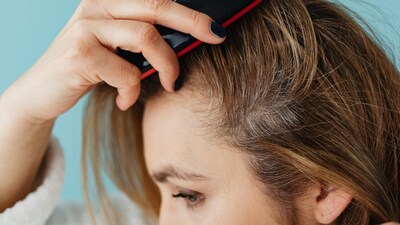 If your scalp is not healthy, your hair becomes thinner, grows slower, and the centre parting becomes wider (Image: Pexels)