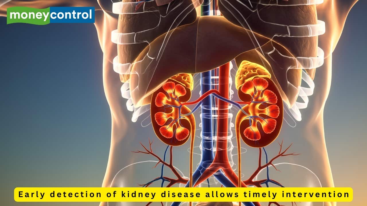 Symptoms of kidney disease don't show early, 5 healthy habits to prevent complications