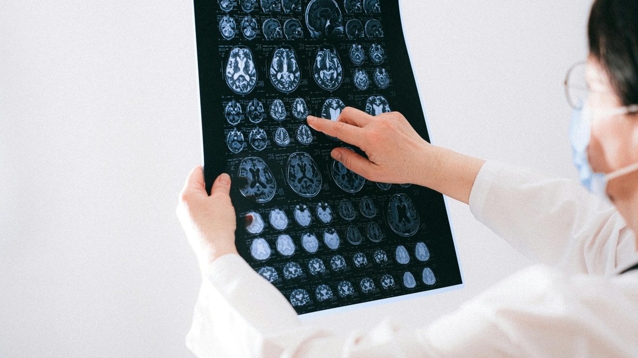 This new AI model can read brain MRIs in seconds, experts say it could change emergency care forever