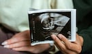 Expecting twins? 6 things you should keep in mind for healthy pregnancy