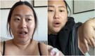 Woman develops third nipple in armpit during pregnancy. Apollo Hospitals doctor reacts