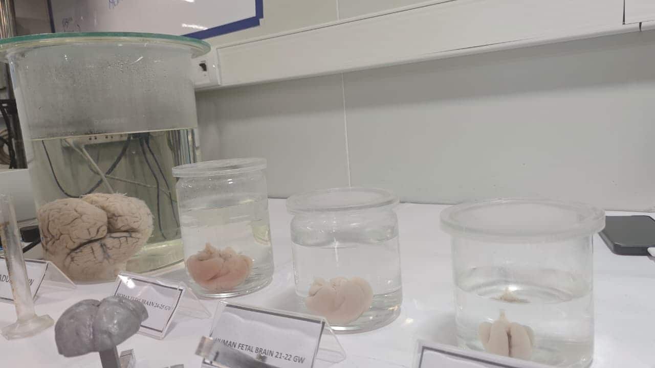 Brain Centre image