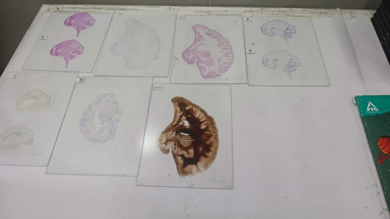 Brain Centre image 4