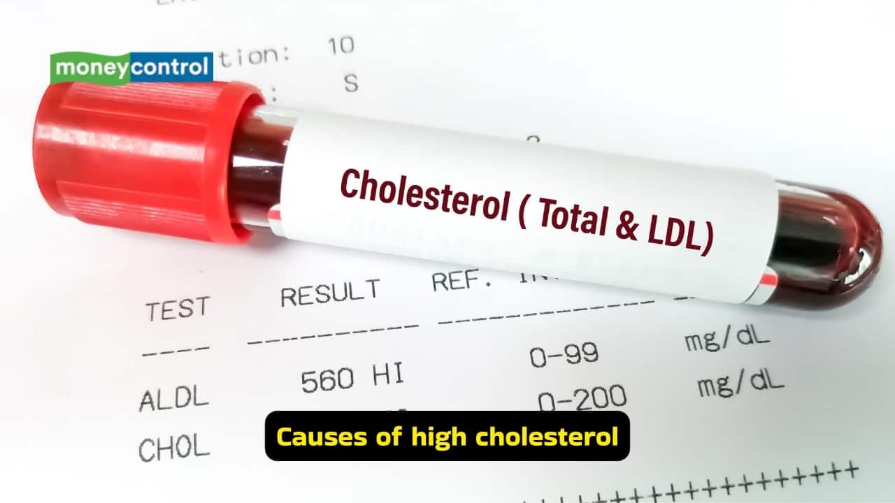 5 common myths about diet and cholesterol people still believe: Neurologist clarifies