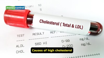 How to reduce high cholesterol: Exercise helps in reducing cholesterol levels as it raises good cholesterol (HDL), improves insulin sensitivity, and boosts heart health (Image: Pexels)