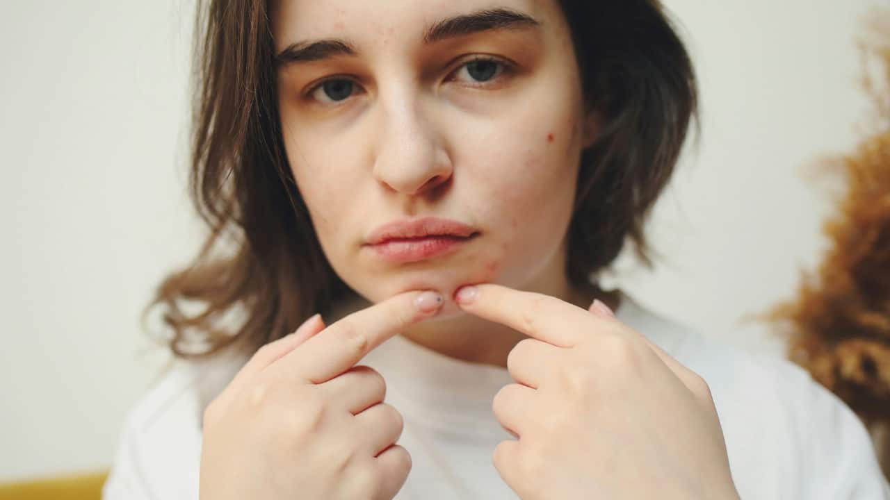 Does your skin behave badly during spring? Dietician shares top food recommendations