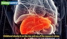 Low intake of protein diet could help slow liver cancer, finds study