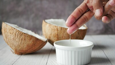 Hair  health benefits of coconut oil: It has natural antifungal and antimicrobial properties that provide relief from dandruff and an itchy scalp (Image: Pexels)
