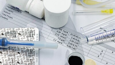 The easiest, and most effective, way to keep track of your body’s inner workings is by monitoring urine colour. (Picture: Pexels)