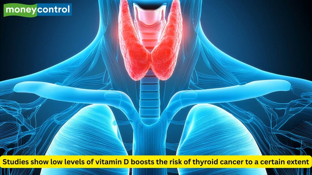 Can low vitamin D level raise thyroid cancer risk? This is what expert has to say
