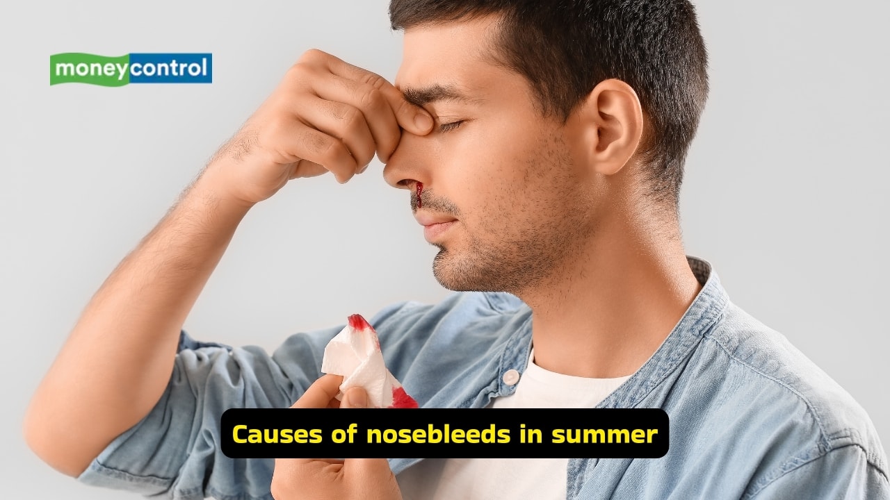 Nosebleeds in summer: ENT specialist gives tips on how to care for dry nostrils