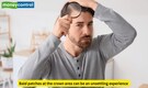 5 tips for hair regrowth on bald patches during summer