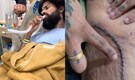 Anurag Dobhal Controversy: UK 07 Rider reveals his stitched wounds and more; says, ‘Zindagi ki nayi shuruaat…’