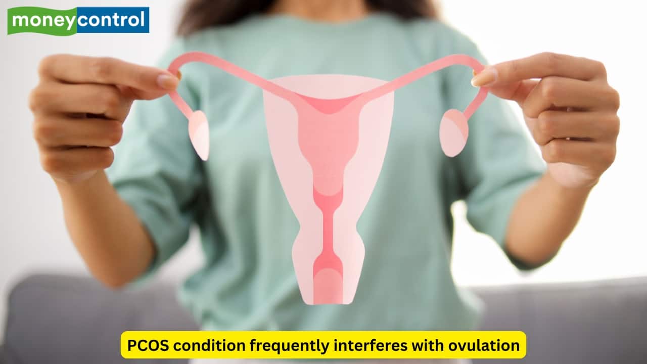 Can PCOS lead to high-risk pregnancy? Padmashree awardee doctor weighs in