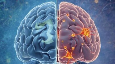 Scientists identify “death switch” in brain linked to Alzheimer’s progression