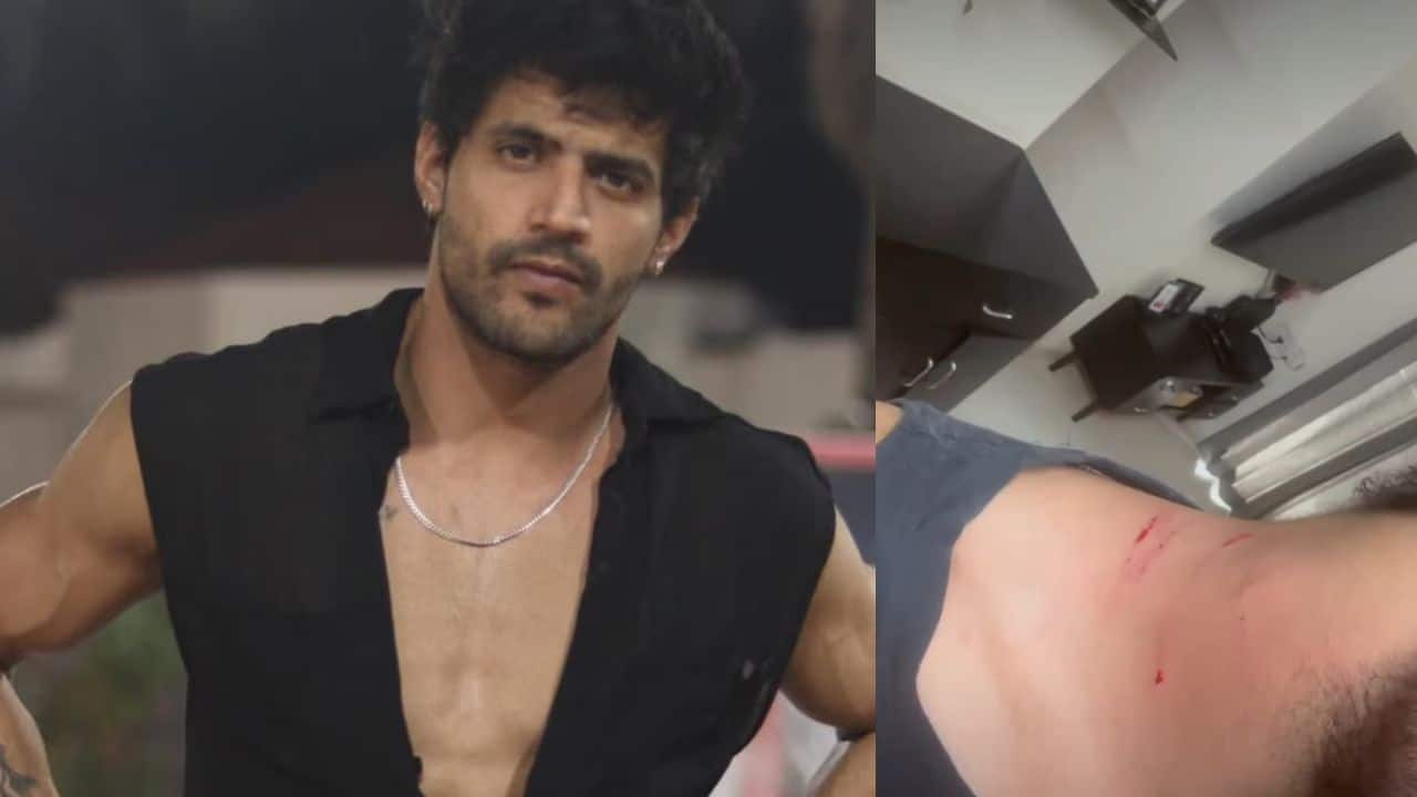 MTV Splitsvilla X6 contestant Sorab Bedi shares video of nail marks and injuries by his ex-girlfriend post a violent confrontation (Watch Clip)
