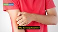 Think mosquitoes bite you more than others? Blame it on your blood group, body scent, even genetics