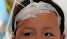 Rare SAT-1 disease strain enters China for first time, triggers cattle culling and border crackdown